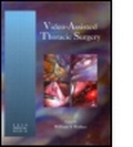 Bild: Video-Assisted Thoracic Surgery - Taylor & Francis