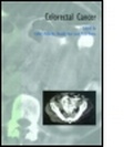 Cover: Colorectal Cancer - Taylor & Francis