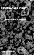 Cover: Epstein-Barr Virus - Caister Academic Press