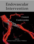 Cover: Endovascular intervention - TFM Publishing Ltd