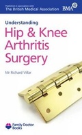 Cover: Understanding Hip & Knee Arthritis Surgery - Family Doctor Publications Ltd