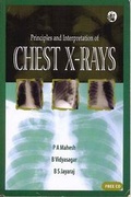 Bild: Principles and Interpretation of Chest X-rays - Anshan Ltd