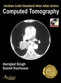 Cover: Mini Atlas of Computed Tomography - Anshan Ltd
