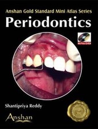Enlarge image Cover: Mini Atlas of Periodontics - Anshan Ltd