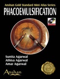 Cover: Mini Atlas of Phacoemulsification - Anshan Ltd