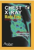 Cover: Chest X-Ray Made Easy - Anshan Ltd