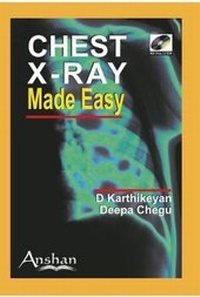Enlarge image Cover: Chest X-Ray Made Easy - Anshan Ltd
