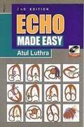 Cover: ECHO Made Easy - Anshan Ltd