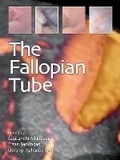 Cover: The Fallopian Tube - Anshan Ltd