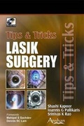 Cover: Lasik Surgery Tips and Tricks - Anshan Ltd
