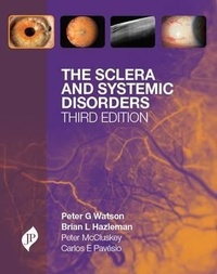 Enlarge image Cover: The Sclera and Systemic Disorders - JP Medical Ltd