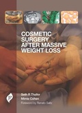 Cover: Cosmetic Surgery after Massive Weight Loss - JP Medical Ltd