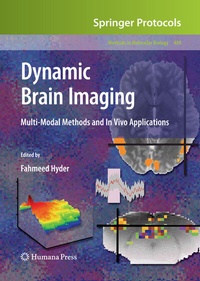 Abbildung von: Dynamic Brain Imaging - Humana