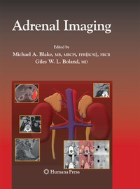 Enlarge image Cover: Adrenal Imaging - Humana Press Inc.