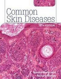 Enlarge image Cover: Common Skin Diseases - Hodder Arnold
