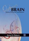 Cover: Osborn's Brain: Imaging, Pathology, and Anatomy - Amirsys, Inc