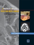 Cover: Specialty Imaging: Head & Neck Cancer - Amirsys, Inc