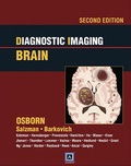 Cover: Diagnostic Imaging: Brain - Amirsys, Inc