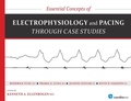 Cover: Essential Concepts of Electrophysiology and Pacing Through Case Studies - Cardiotext Publishing