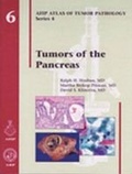 Cover: Tumors of the Pancreas - American Registry of Pathology