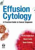 Cover: Effusion Cytology - Demos Medical Publishing