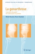 Cover: La gonarthrose - Springer