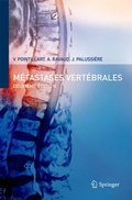 Cover: M&eacute;tastases vert&eacute;brales - Springer