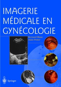 Abbildung von: Imagerie médicale en gynécologie - Springer