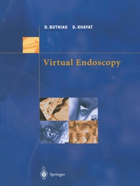 Abbildung von: Virtual Endoscopy - Springer