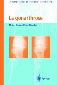 Abbildung von: La gonarthrose - Springer