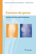 Cover: Fractures du genou - Springer