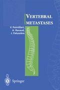 Cover: Vertebral metastases - Springer