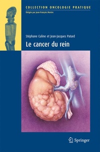 Abbildung von: Le Cancer du rein - Springer