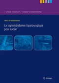 Cover: Pr&eacute;cis d'intervention. La sigmo&iuml;dectomie laparoscopique pour cancer - Springer