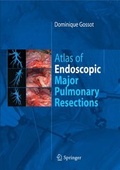 Bild: Atlas of endoscopic major pulmonary resections - Springer