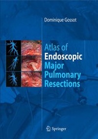 Abbildung von: Atlas of endoscopic major pulmonary resections - Springer