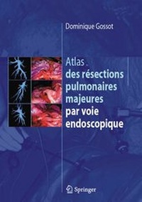 Abbildung von: Atlas des résections pulmonaires majeures par voie endoscopique - Springer