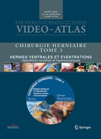 Abbildung von: Vidéo-Atlas Chirurgie herniaire - Springer