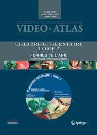 Abbildung von: Vidéo atlas Chirurgie herniaire - Springer