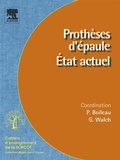 Cover: Proth&egrave;ses d'&eacute;paule. &Eacute;tat actuel - Elsevier
