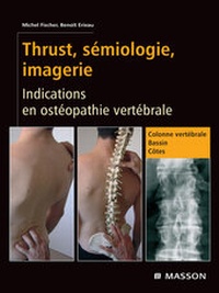 Abbildung von: Thrust, sémiologie, imagerie - Elsevier