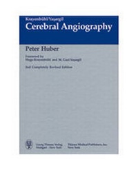 Abbildung von: Cerebral Angiography - Thieme