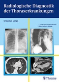 Cover: Radiologische Diagnostik der Thoraxerkrankungen - Thieme