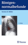Cover: R&ouml;ntgennormalbefunde - Thieme