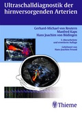 Cover: Ultraschalldiagnostik der hirnversorgenden Arterien - Thieme