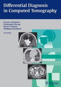 Abbildung von: Differential Diagnosis in Computed Tomography - Thieme
