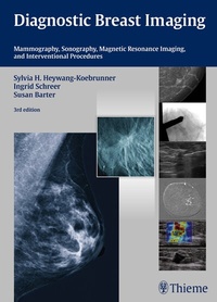 Abbildung von: Diagnostic Breast Imaging - Thieme