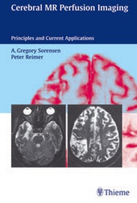 Abbildung von: Cerebral MR Perfusion Imaging - Thieme