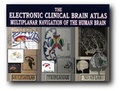 Cover: The Elektronic Clinical Brain Atlas on CD-ROM - Thieme