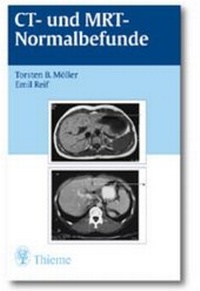 Enlarge image Cover: CT und MRT Normalbefunde - Thieme
